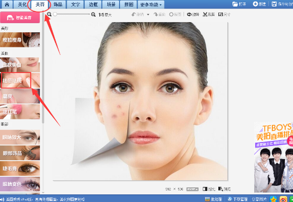 美圖秀秀怎么去除痘痘疤痕？美圖秀秀去除痘痘疤痕圖文教程